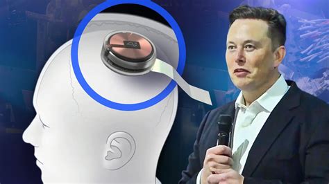 elon musk rfid chip|Elon Musk's Neuralink has put in its first human brain implant .